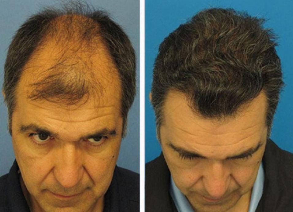 СПРЕЙ – ДЛЯ ВІДНОВЛЕННЯ ВОЛОССЯ