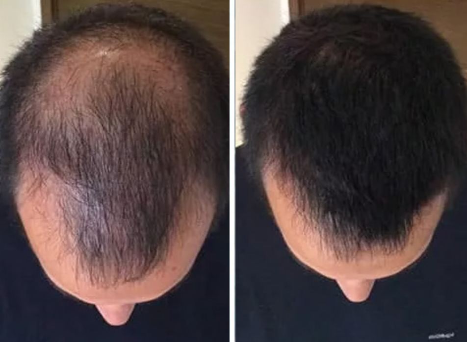 СПРЕЙ – ДЛЯ ВІДНОВЛЕННЯ ВОЛОССЯ