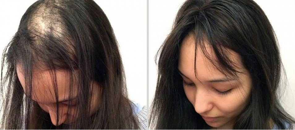 СПРЕЙ – ДЛЯ ВІДНОВЛЕННЯ ВОЛОССЯ