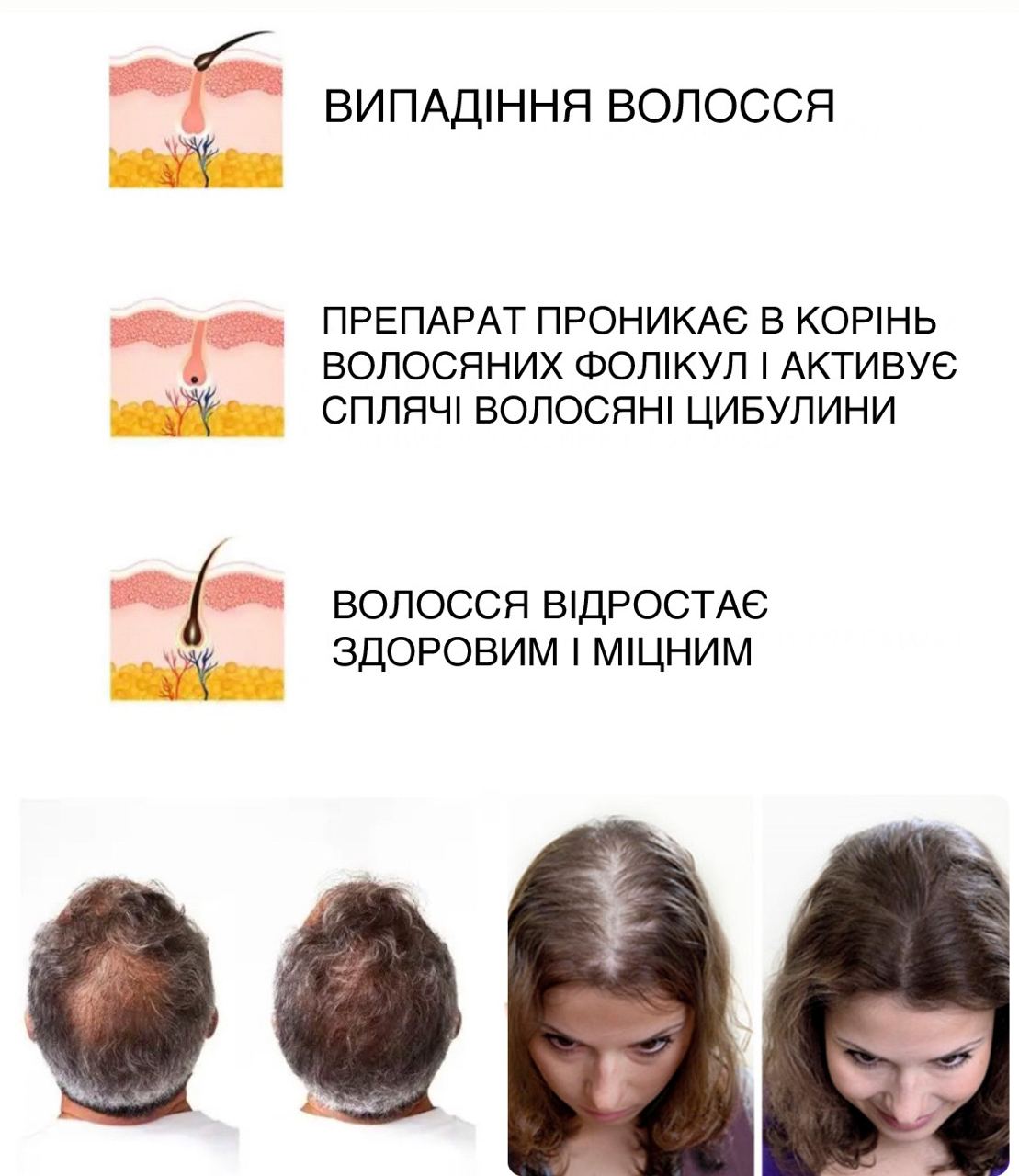 СПРЕЙ – ДЛЯ ВІДНОВЛЕННЯ ВОЛОССЯ